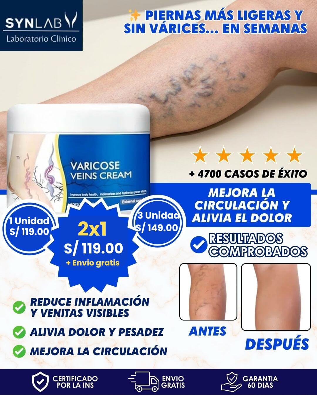 Crema Anti-Varices 100% Natural